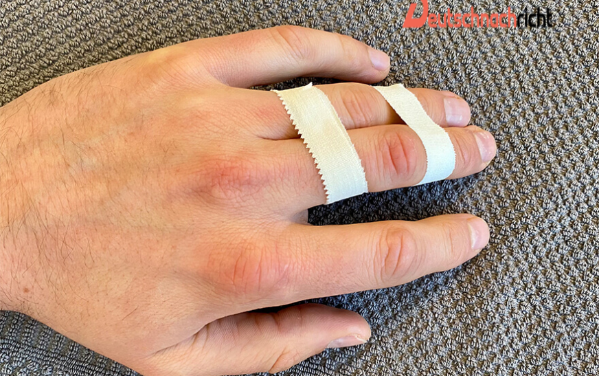 Kapselriss Finger – Ursachen, Symptome und Behandlung